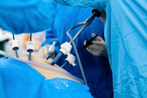 Laparoscopic surgery for gynecology at Sri Bindu Hospital in Kadapa, offering advanced and minimally invasive treatments.