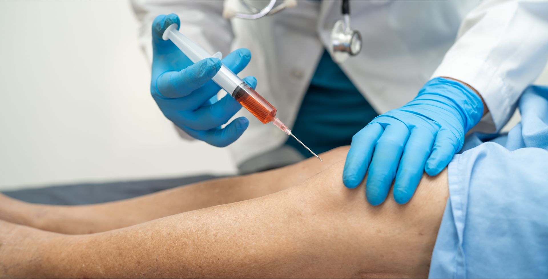 PRP injections treatment at Sri Bindu Hospital Kadapa